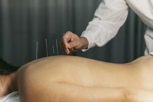 Studium Akupunktur
